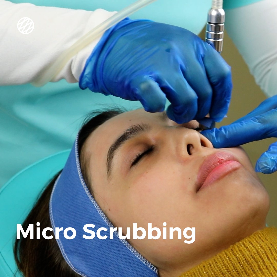 Microneedling