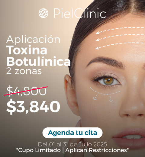 20% off en Toxina Botulínica - 2 zonas